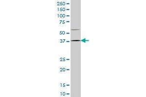 HOXD9 monoclonal antibody (M01), clone 2A9 Western Blot analysis of HOXD9 expression in NIH/3T3 . (HOXD9 antibody  (AA 146-210))