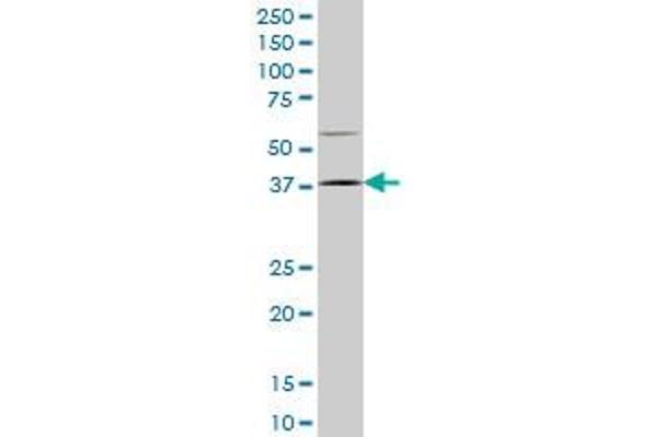 HOXD9 antibody  (AA 146-210)