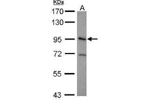WB Image Sample (30 ug of whole cell lysate) A: HeLa 7. (Integrin beta 5 antibody  (Center))