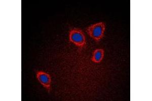 Immunofluorescent analysis of Caveolin 1 staining in A431 cells.