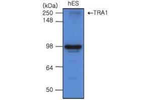 Western Blotting (WB) image for anti-Heat Shock Protein 90kDa beta (Grp94), Member 1 (HSP90B1) (AA 676-803) antibody (ABIN317570) (GRP94 antibody  (AA 676-803))