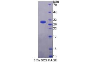 SDS-PAGE (SDS) image for Glutathione S-Transferase alpha 3 (GSTA3) (AA 1-229) protein (His tag) (ABIN4988489) (GSTA3 Protein (AA 1-229) (His tag))