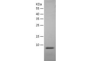 Western Blotting (WB) image for Defensin beta 2 (BD-2) (AA 21-71) protein (His tag) (ABIN7286830) (beta 2 Defensin Protein (AA 21-71) (His tag))
