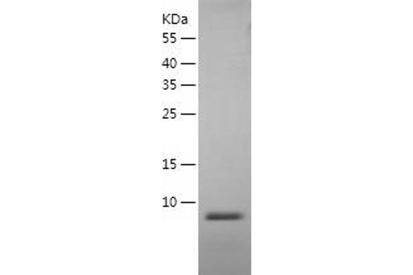 beta 2 Defensin Protein (AA 21-71) (His tag)