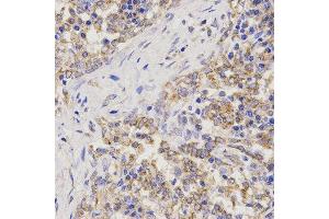 Immunohistochemistry (IHC) image for anti-Tumor Necrosis Factor Receptor Superfamily, Member 1B (TNFRSF1B) antibody (ABIN3021424) (TNFRSF1B antibody)