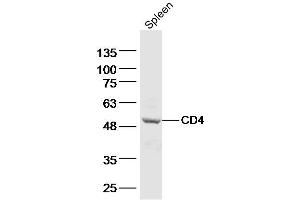 Mouse spleen lysates probed with CD4 Polyclonal Antibody, Unconjugated  at 1:500 dilution and 4˚C overnight incubation. (CD4 antibody  (AA 231-330))