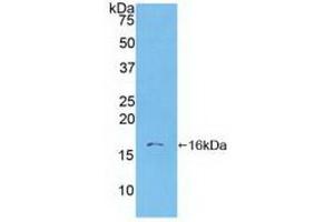 Detection of Recombinant S100A6, Human using Polyclonal Antibody to S100 Calcium Binding Protein A6 (S100A6) (S100A6 antibody  (AA 1-90))