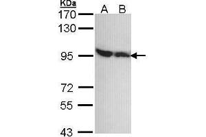 WB Image Sample (30 ug of whole cell lysate) A: A431 , B: H1299 7. (DDX1 antibody  (Internal Region))