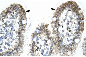 Rabbit Anti-MYCBP Antibody Catalog Number: ARP31860 Paraffin Embedded Tissue: Human Intestine Cellular Data: Epithelial cells of intestinal villas Antibody Concentration: 4. (MYCBP antibody  (Middle Region))