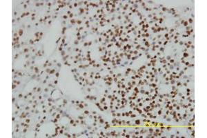 Image no. 1 for anti-Zinc Finger Protein 143 (ZNF143) (AA 1-627) antibody (ABIN466122) (ZNF143 antibody  (AA 1-627))