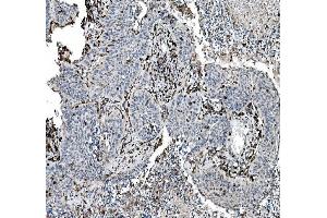 IHC analysis of CD45 using anti-CD45 antibody (ABIN7602775).