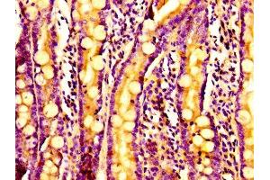 Immunohistochemistry of paraffin-embedded human small intestine tissue using ABIN7143085 at dilution of 1:100 (ARPC2 antibody  (AA 1-250))