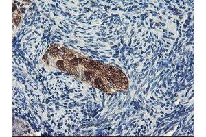 Immunohistochemistry (IHC) image for anti-Dipeptidyl-Peptidase 8 (DPP8) antibody (ABIN1497835) (DPP8 antibody)