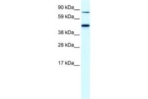 Western Blotting (WB) image for anti-erythrocyte Membrane Protein Band 4.2 (EPB42) antibody (ABIN2460809) (EPB42 antibody)