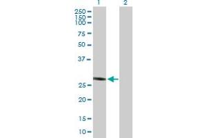 Western Blot analysis of PGLS expression in transfected 293T cell line by PGLS MaxPab polyclonal antibody. (PGLS antibody  (AA 1-258))