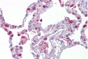 Immunohistochemistry with Lung tissue at an antibody concentration of 5µg/ml using anti-PGDS antibody (ARP48763_P050) (PTGDS antibody  (N-Term))