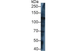 Western Blot; Sample: Human U2OS cell lysate; ;Primary Ab: 1µg/ml Rabbit Anti-Rat KIF5A Antibody;Second Ab: 0. (KIF5A antibody  (AA 823-1027))