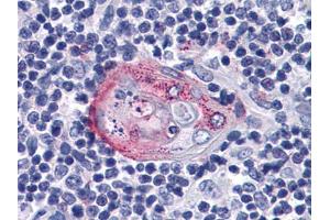 Immunohistochemical analysis of paraffin-embedded human Thymus tissues using anti-AKT2 mAb (AKT2 antibody)