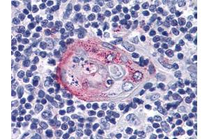 Immunohistochemical analysis of paraffin-embedded human Thymus tissues using anti-AKT2 mAb
