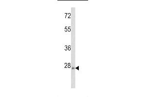 Western blot analysis of ARHE Antibody (Center)(Cat. (RND3 antibody  (AA 133-165))