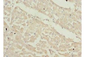 Immunohistochemistry of paraffin-embedded human heart tissue using ABIN7176063 at dilution of 1:100 (ZFYVE16 antibody  (AA 1-280))