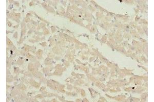 Immunohistochemistry of paraffin-embedded human heart tissue using ABIN7176063 at dilution of 1:100