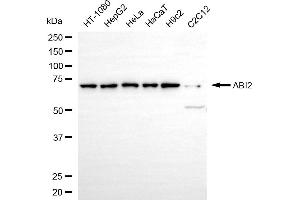 anti-Abl-Interactor 2 (ABI2) antibody