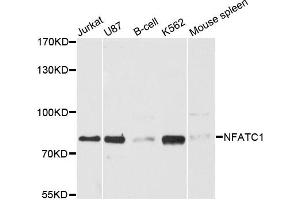 Western blot analysis of extracts of various cell lines, using NFATC1 antibody (ABIN5970728) at 1:3000 dilution.