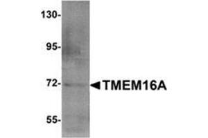 Western blot analysis of TMEM16A (arrow) in A549 cell lysate with TMEM16A Antibody  at 1 μg/ml.