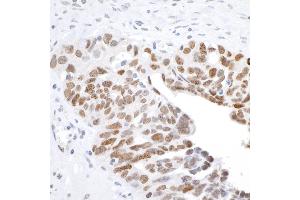 Immunohistochemistry (IHC) image for anti-H2A Histone Family, Member X (H2AFX) (C-Term) antibody (ABIN7449536) (H2AFX antibody  (C-Term))