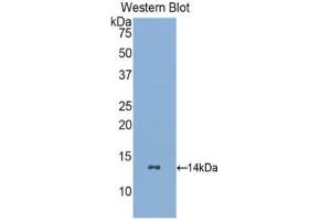 Western blot analysis of recombinant Human GCSFR. (CSF3R antibody  (AA 26-138))
