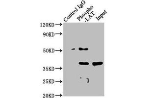 Immunoprecipitating Phospho-LAT in A549 whole cell lysate  Lane 1: Rabbit control IgG(1μg)instead of ABIN7127705 in A549 whole cell lysate. (Recombinant LAT antibody  (pTyr191))