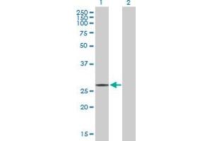 Western Blot analysis of SNAP25 expression in transfected 293T cell line by SNAP25 MaxPab polyclonal antibody. (SNAP25 antibody  (AA 1-206))