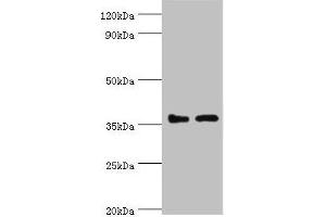 Western blot All lanes: BRCC3 antibody at 3 μg/mL Lane 1: 293T whole cell lysate Lane 2: MCF-7 whole cell lysate Secondary Goat polyclonal to rabbit IgG at 1/10000 dilution Predicted band size: 37, 34, 24, 29 kDa Observed band size: 37 kDa (BRCC3 antibody  (AA 1-316))