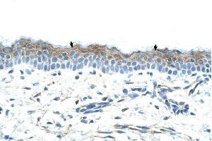 SERPINB5 antibody was used for immunohistochemistry at a concentration of 4-8 ug/ml to stain Squamous epithelial cells (arrows) in Human Skin. (SERPINB5 antibody)