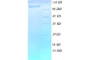 SDS-PAGE (SDS) image for DEAD (Asp-Glu-Ala-Asp) Box Polypeptide 27 (DDX27) (AA 30-794), (partial) protein (His-SUMO Tag) (ABIN4976600)