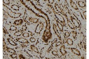 ABIN6276587 at 1/100 staining Human kidney tissue by IHC-P. (PML antibody  (N-Term))