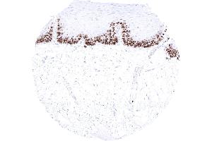 Esophageal squamous epithelium with moderate to strong nuclear MCM3 staining of suprabasal and basal cells