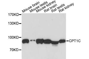 Western blot analysis of extracts of various cell lines, using CPT1C antibody (ABIN6291920) at 1:3000 dilution. (CPT1C antibody)