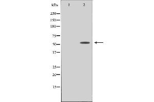 Western blot analysis of extracts from COLO cells using PPHLN antibody. (PPHLN1 antibody  (N-Term))