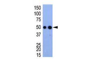 Image no. 1 for anti-HA-Tag antibody (ABIN356535) (HA-Tag antibody)