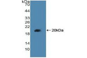 Western blot analysis of recombinant Human PPARd. (PPARD antibody  (AA 260-426))