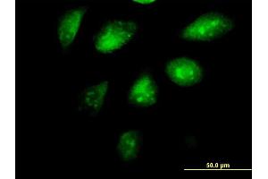Immunofluorescence of monoclonal antibody to SETDB1 on HeLa cell. (SETDB1 antibody  (AA 2-100))