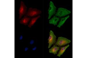 ABIN6258032 and ABIN6275061 staining  cells by IF/ICC. (DPYSL4 antibody  (Internal Region))