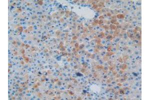 IHC-P analysis of Mouse Liver Tissue, with DAB staining. (MAPT antibody  (AA 92-400))