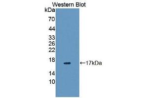 Western blot analysis of the recombinant protein. (VIPR1 antibody  (AA 34-146))