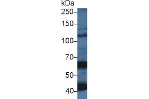 Western Blot; Sample: Porcine Cerebrum lysate; Primary Ab: 5µg/ml Rabbit Anti-Human OAS1 Antibody Second Ab: 0. (OAS1 antibody  (AA 74-165))