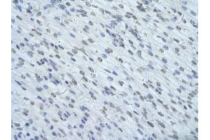 Rabbit Anti-HNRNPUL1 Antibody       Paraffin Embedded Tissue:  Human cardiac cell   Cellular Data:  Epithelial cells of renal tubule  Antibody Concentration:   4. (HNRNPUL1 antibody  (C-Term))
