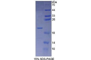SDS-PAGE (SDS) image for Proteasome Maturation Protein (POMP) (AA 1-141) protein (His tag) (ABIN6238767) (POMP Protein (AA 1-141) (His tag))