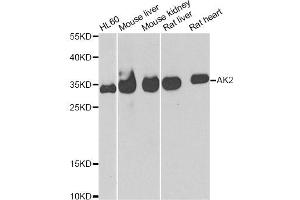 Western blot analysis of extracts of various cell lines, using AK2 antibody (ABIN5973904) at 1/1000 dilution. (Adenylate Kinase 2 antibody)